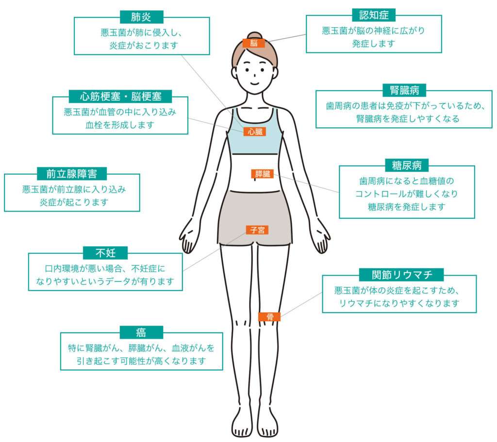 口の中の悪玉菌が原因で発症する病気