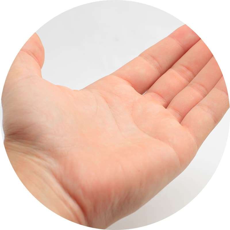 体部白癬