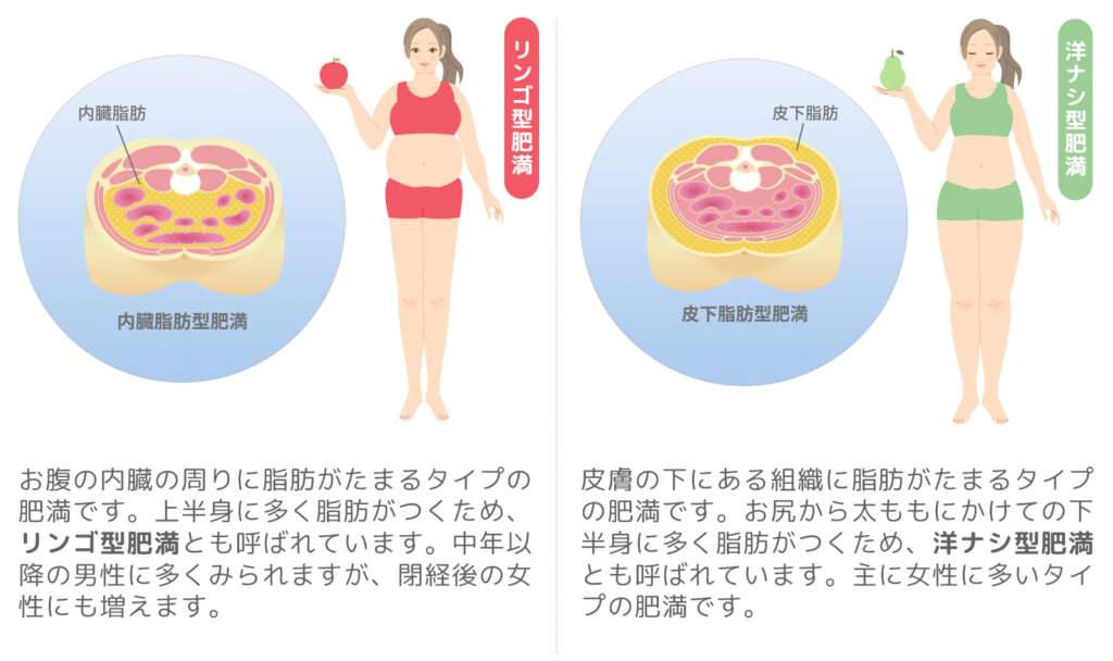 りんご型肥満と洋ナシ型肥満
