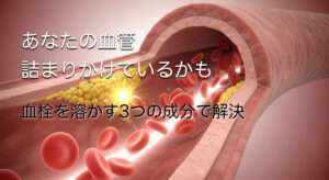血栓の詰まりを解決