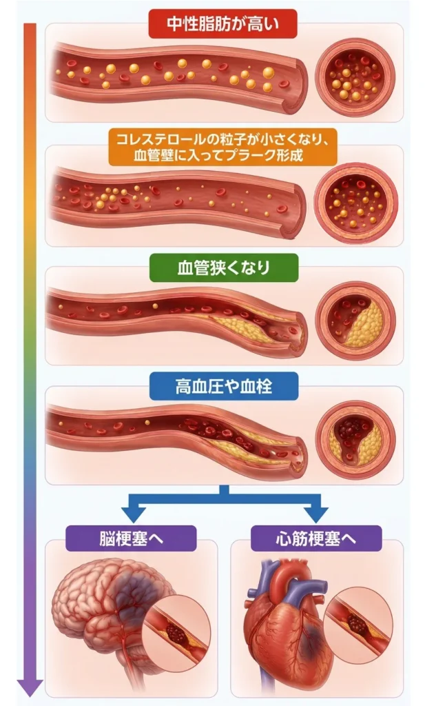 脳梗塞や心筋梗塞になるまでの経過